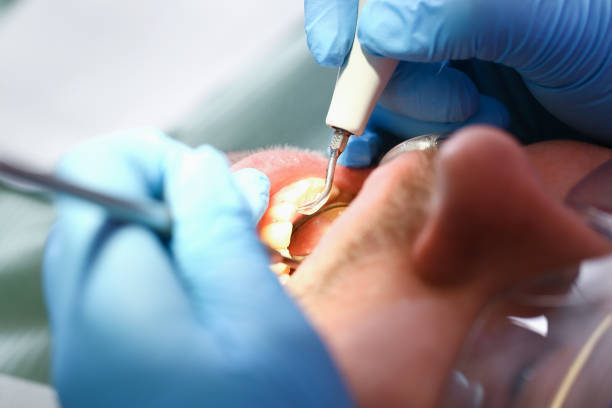 Best Emergency Broken Tooth Repair in East Northport, NY